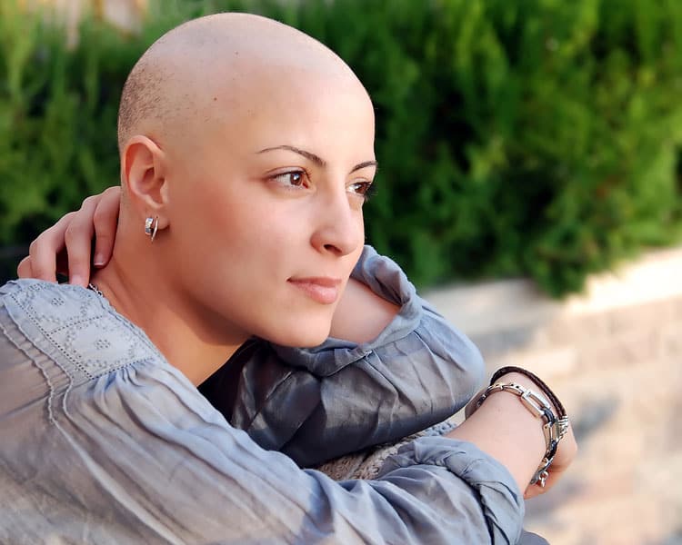 Femme atteinte d'un cancer sans cheveux