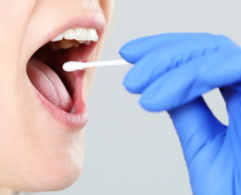 Eine Frau mit geschwächtem Immunsystem entnimmt eine Probe aus ihrem Mund.